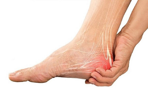 Viêm gân gót chân có nguy hiểm không